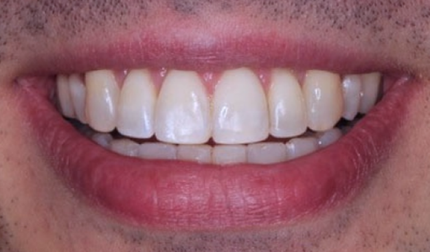 face - Dr Nina Shaffie