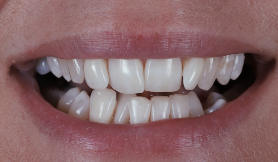 face - Dr Nina Shaffie