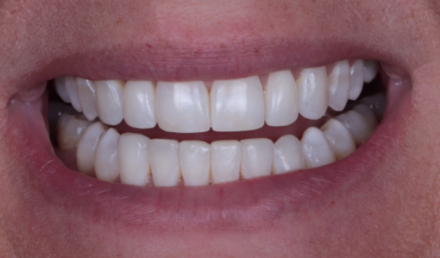 face - Dr Nina Shaffie