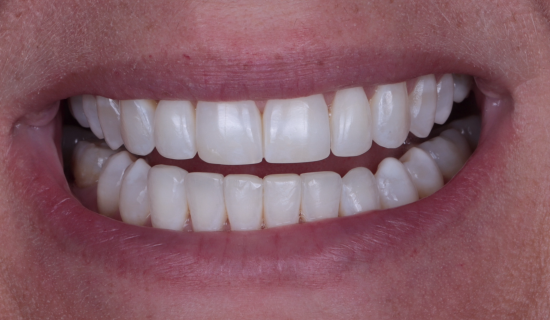 face - Dr Nina Shaffie