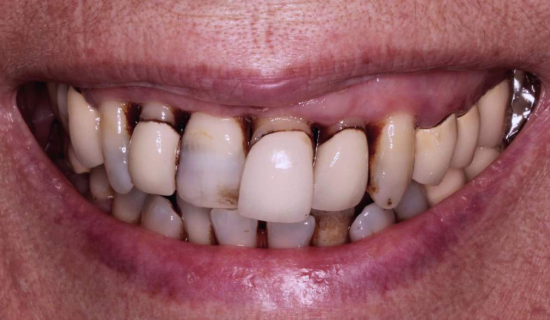 face - Dr Nina Shaffie