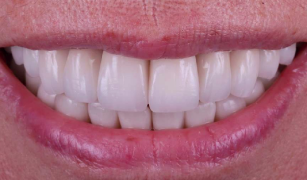 face - Dr Nina Shaffie