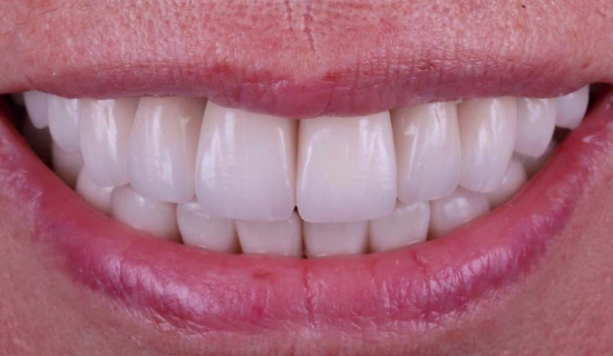 face - Dr Nina Shaffie