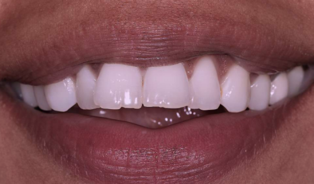 face - Dr Nina Shaffie