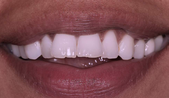 face - Dr Nina Shaffie