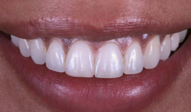 face - Dr Nina Shaffie