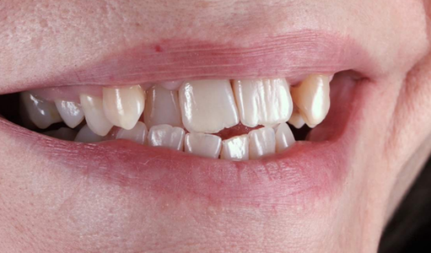 face - Dr Nina Shaffie