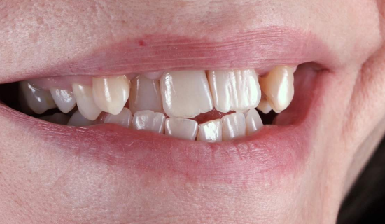 face - Dr Nina Shaffie