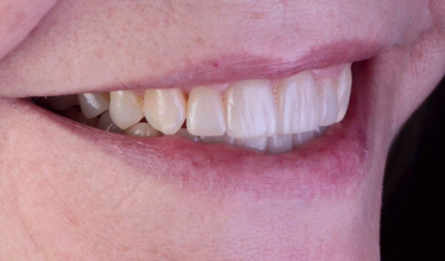 face - Dr Nina Shaffie