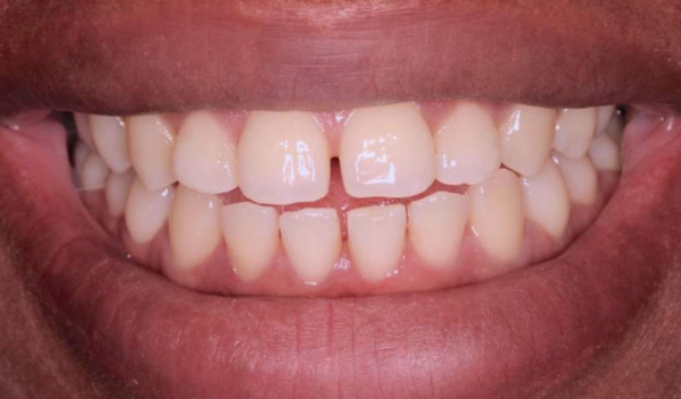 face - Dr Nina Shaffie