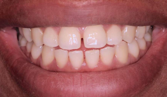 face - Dr Nina Shaffie