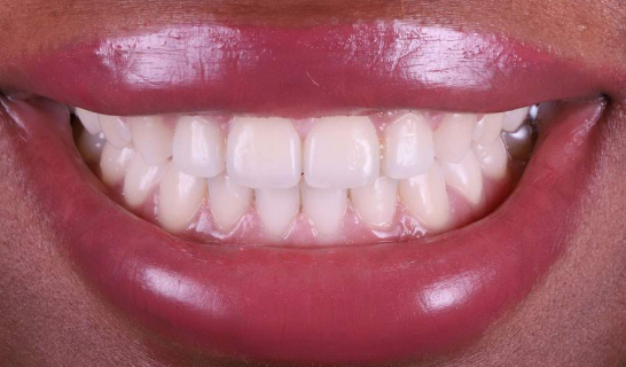 face - Dr Nina Shaffie