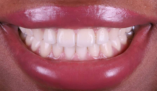 face - Dr Nina Shaffie