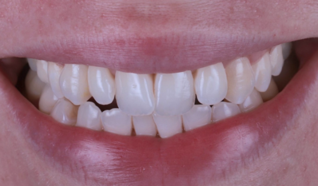 face - Dr Nina Shaffie