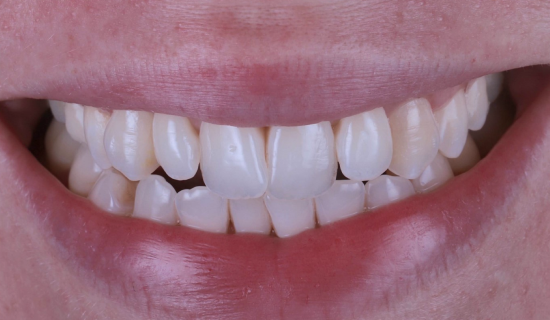 face - Dr Nina Shaffie