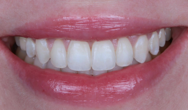 face - Dr Nina Shaffie