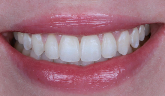 face - Dr Nina Shaffie