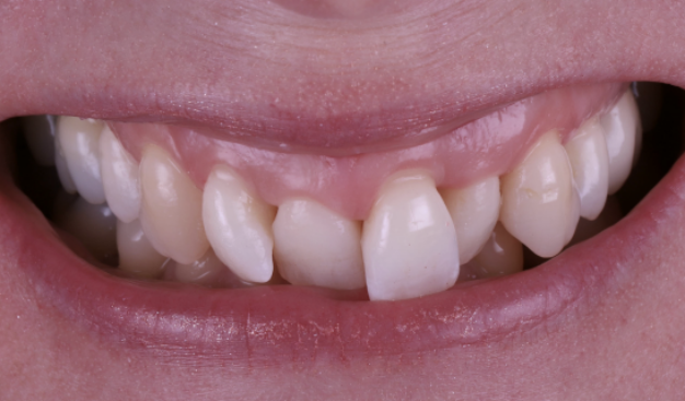 face - Dr Nina Shaffie