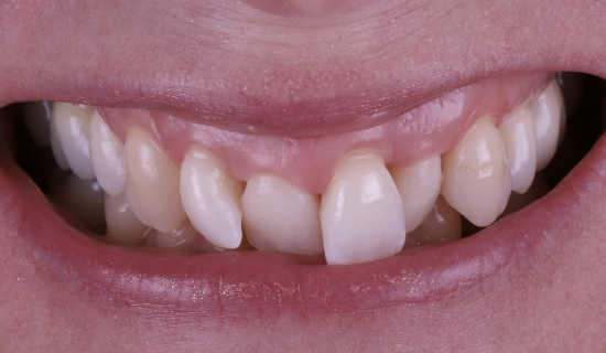 face - Dr Nina Shaffie