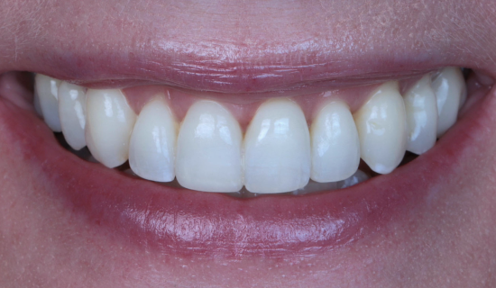 face - Dr Nina Shaffie