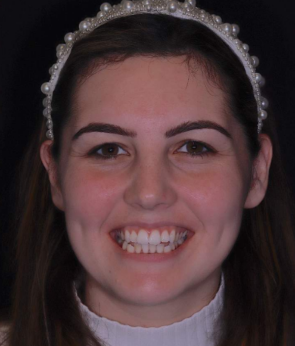 face - Dr Nina Shaffie