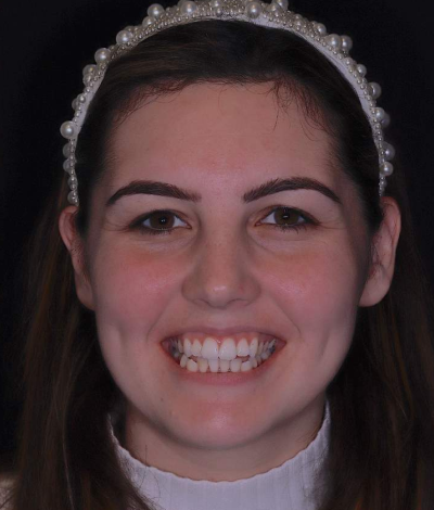 face - Dr Nina Shaffie