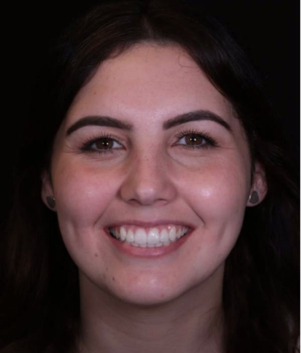 face - Dr Nina Shaffie