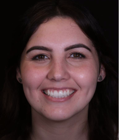 face - Dr Nina Shaffie