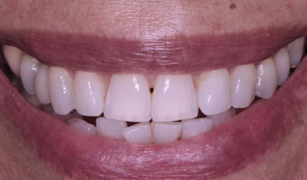 face - Dr Nina Shaffie