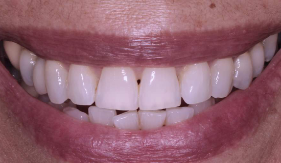 face - Dr Nina Shaffie