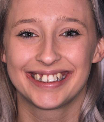 face - Dr Nina Shaffie