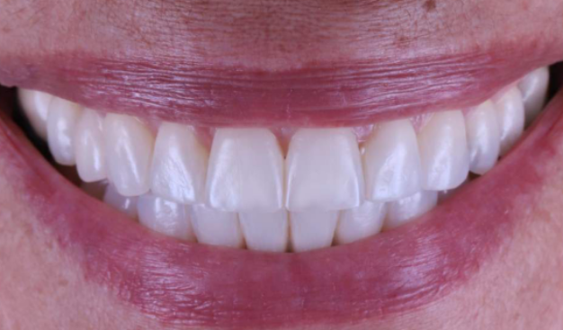 face - Dr Nina Shaffie