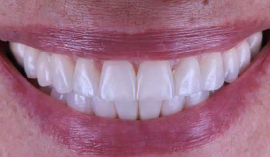 face - Dr Nina Shaffie