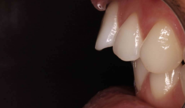 face - Dr Nina Shaffie