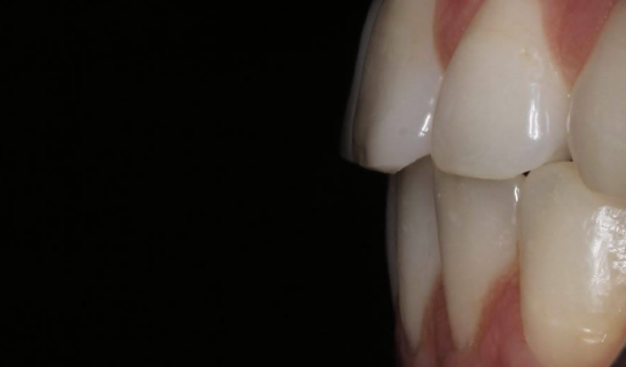 face - Dr Nina Shaffie