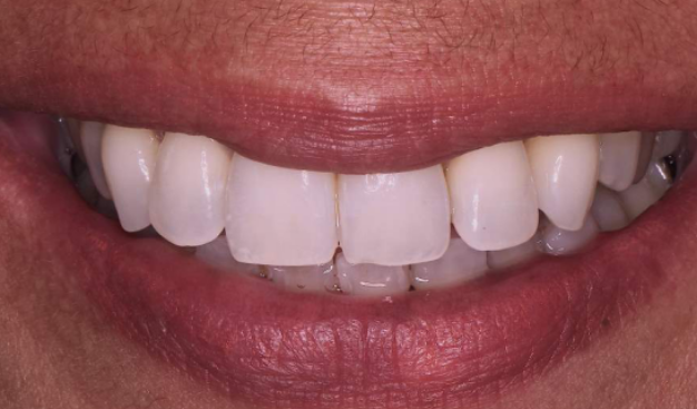 face - Dr Nina Shaffie