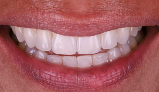 face - Dr Nina Shaffie