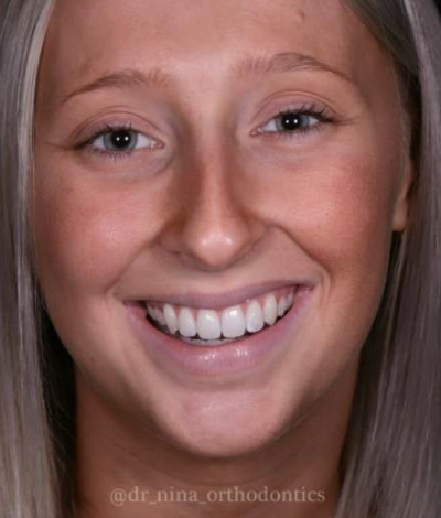 face - Dr Nina Shaffie