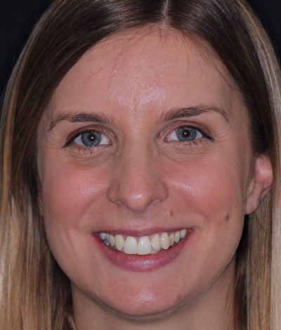 face - Dr Nina Shaffie