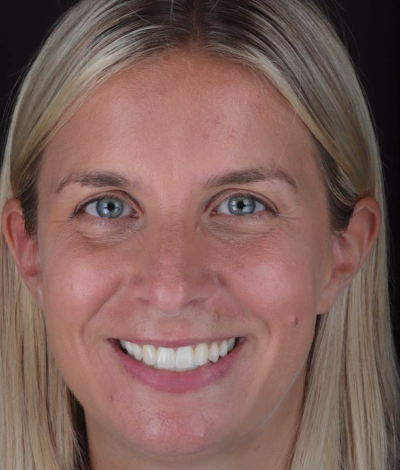 face - Dr Nina Shaffie