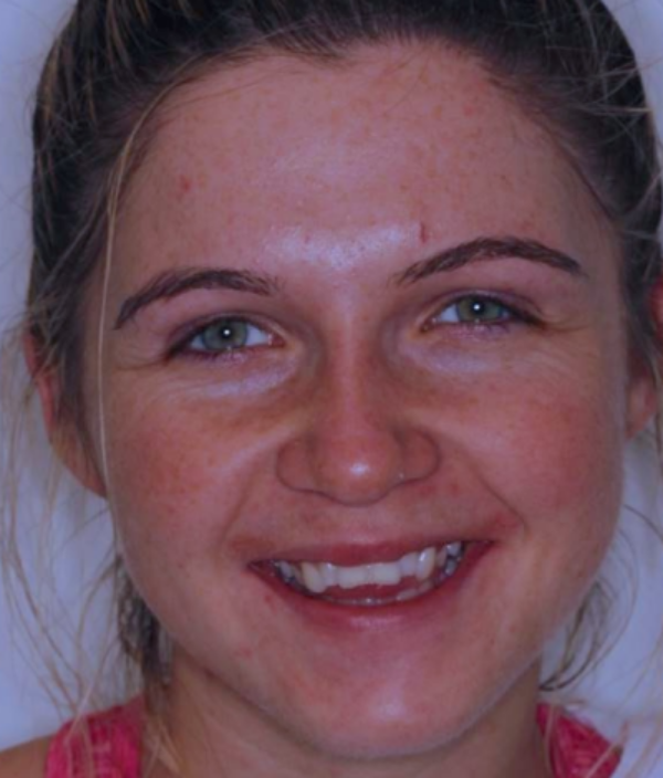 face - Dr Nina Shaffie