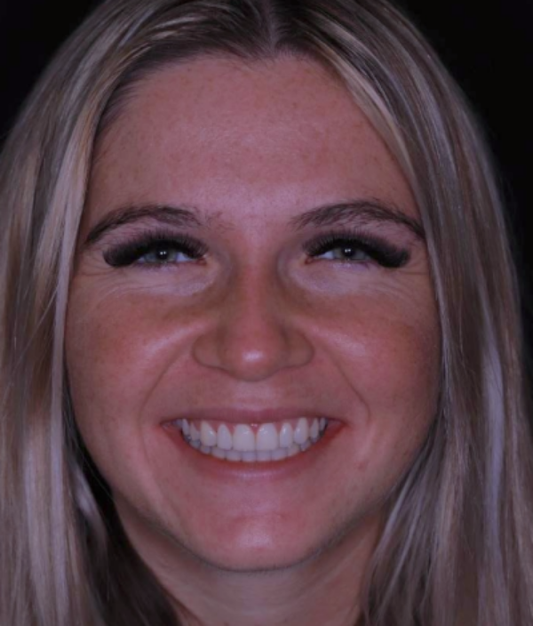 face - Dr Nina Shaffie