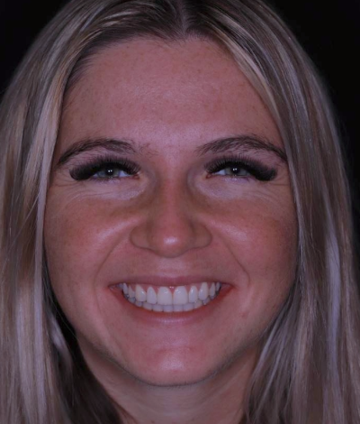 face - Dr Nina Shaffie