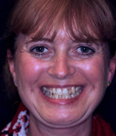 face - Dr Nina Shaffie