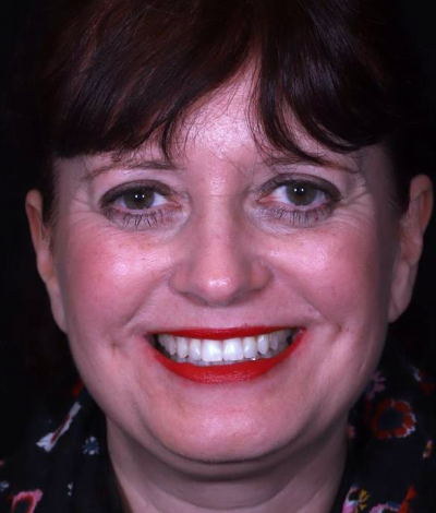 face - Dr Nina Shaffie