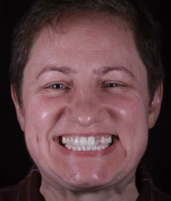 face - Dr Nina Shaffie