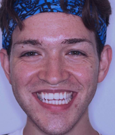 face - Dr Nina Shaffie