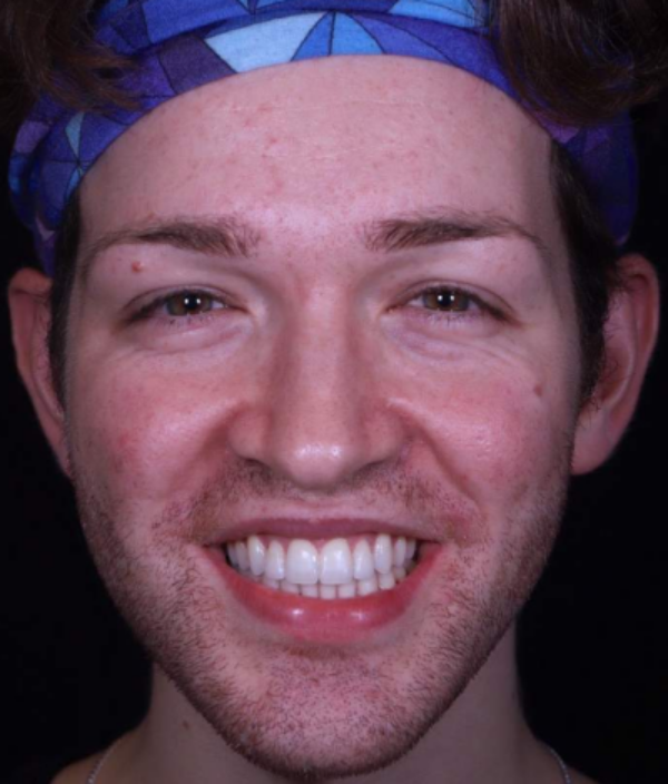 face - Dr Nina Shaffie