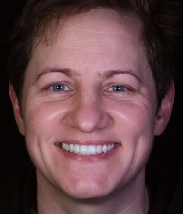 face - Dr Nina Shaffie