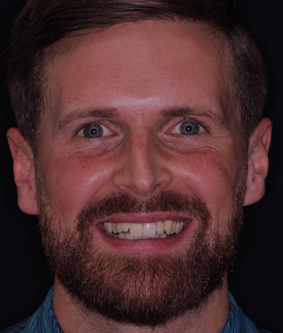 face - Dr Nina Shaffie